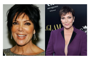 Kris-Jenner-Neck-Lift-Face-Lift