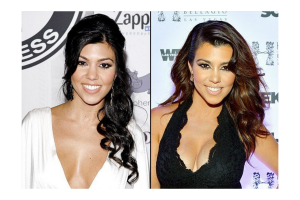 kourtney-kardashian-breast-implants