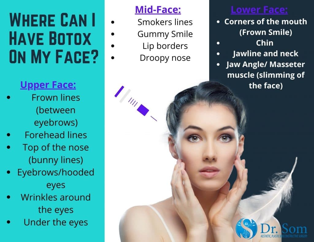 Botox-On-Face-Infographic