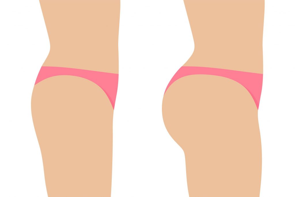 The Brazilian Butt Lift: Why More And More Women Are Getting It